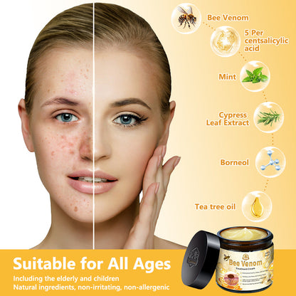 Turonu™ Bee Venom Skin Treatment Cream👨‍⚕[🐝𝐎𝐟𝐟𝐢𝐜𝐢𝐚𝐥 𝐁𝐫𝐚𝐧𝐝 𝐒𝐭𝐨𝐫𝐞🐝](👨‍⚕Suitable for all skin types - Last 30 mins 80% off)