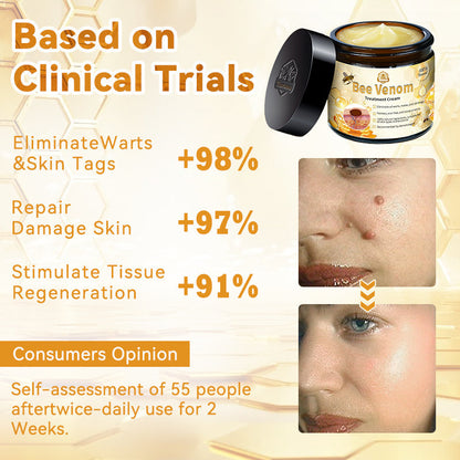 Turonu™ Bee Venom Skin Treatment Cream👨‍⚕[🐝𝐎𝐟𝐟𝐢𝐜𝐢𝐚𝐥 𝐁𝐫𝐚𝐧𝐝 𝐒𝐭𝐨𝐫𝐞🐝](👨‍⚕Suitable for all skin types - Last 30 mins 80% off)